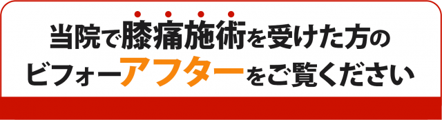 当院で膝痛施術を受けた方のビフォーアフターをご覧ください