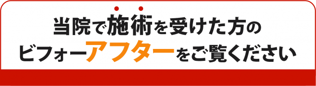 当院で施術を受けた方のビフォーアフターをご覧ください